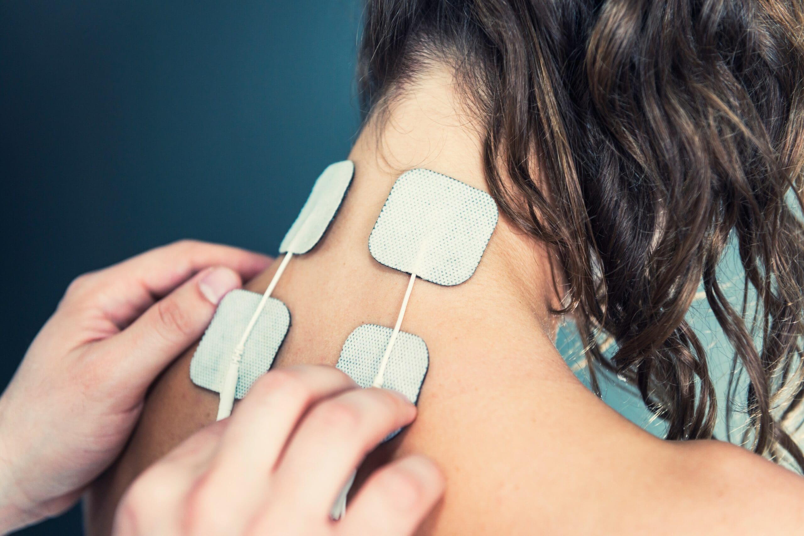 TENS – transcutaneous electrical nerve stimulation