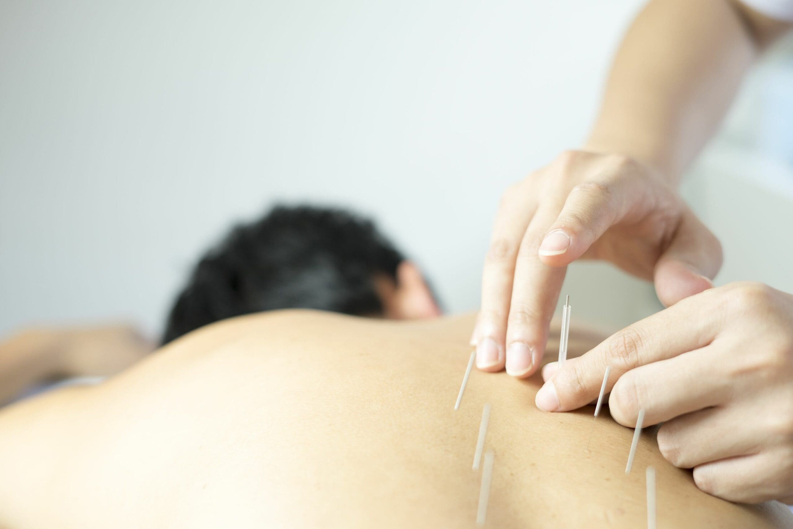 Acupuncture helps with hay fever symptoms