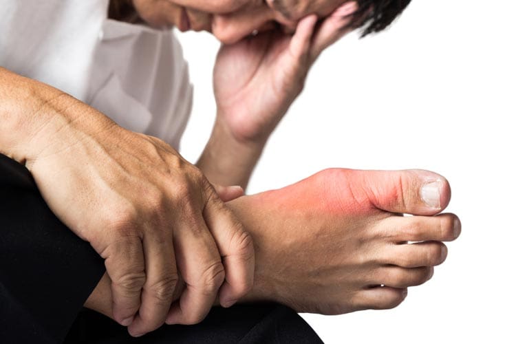 Gout: two-thirds of Australians don’t have ideal control