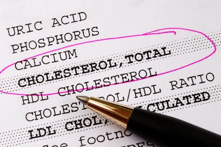 Cholesterol: what is your target?