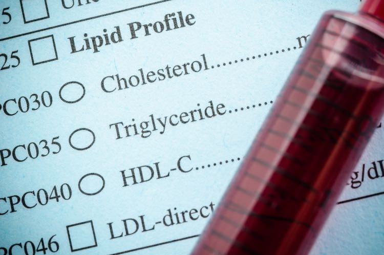 Cholesterol tests
