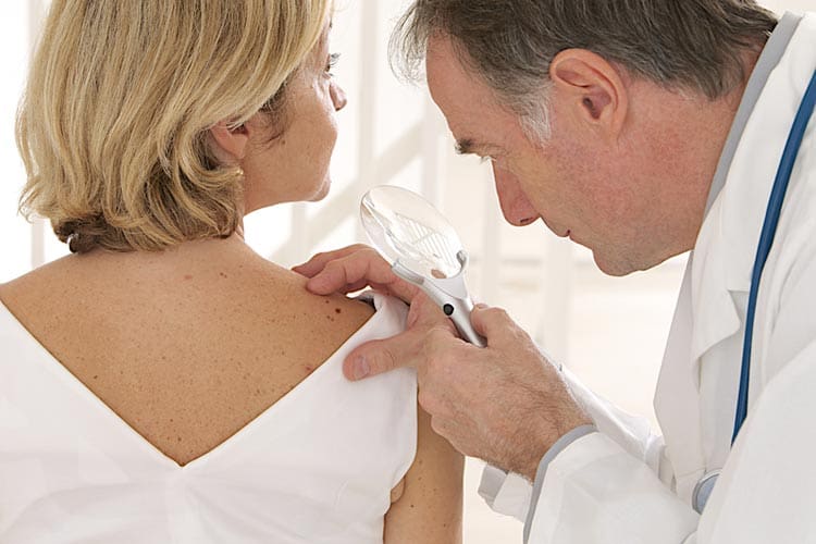 Skin cancer: the warning signs