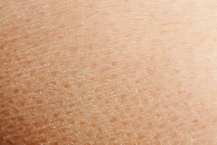 Dry skin: self-care
