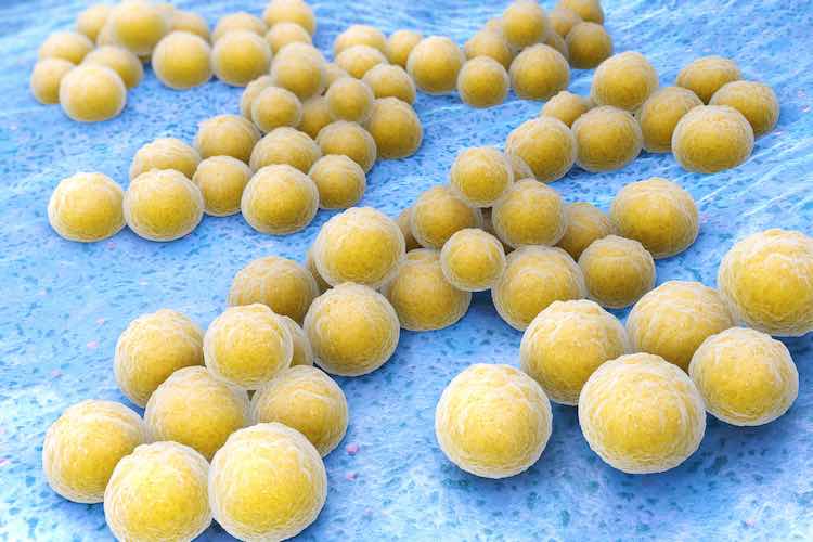 MRSA superbug infections rising in kids with eczema