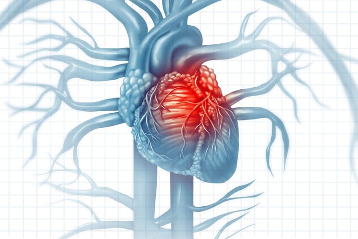 Heart disease is a risk for severe COVID-19 and complications