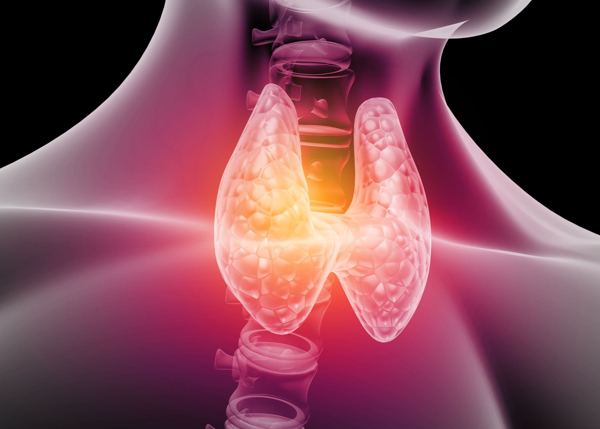 What is Thyroid Cancer?