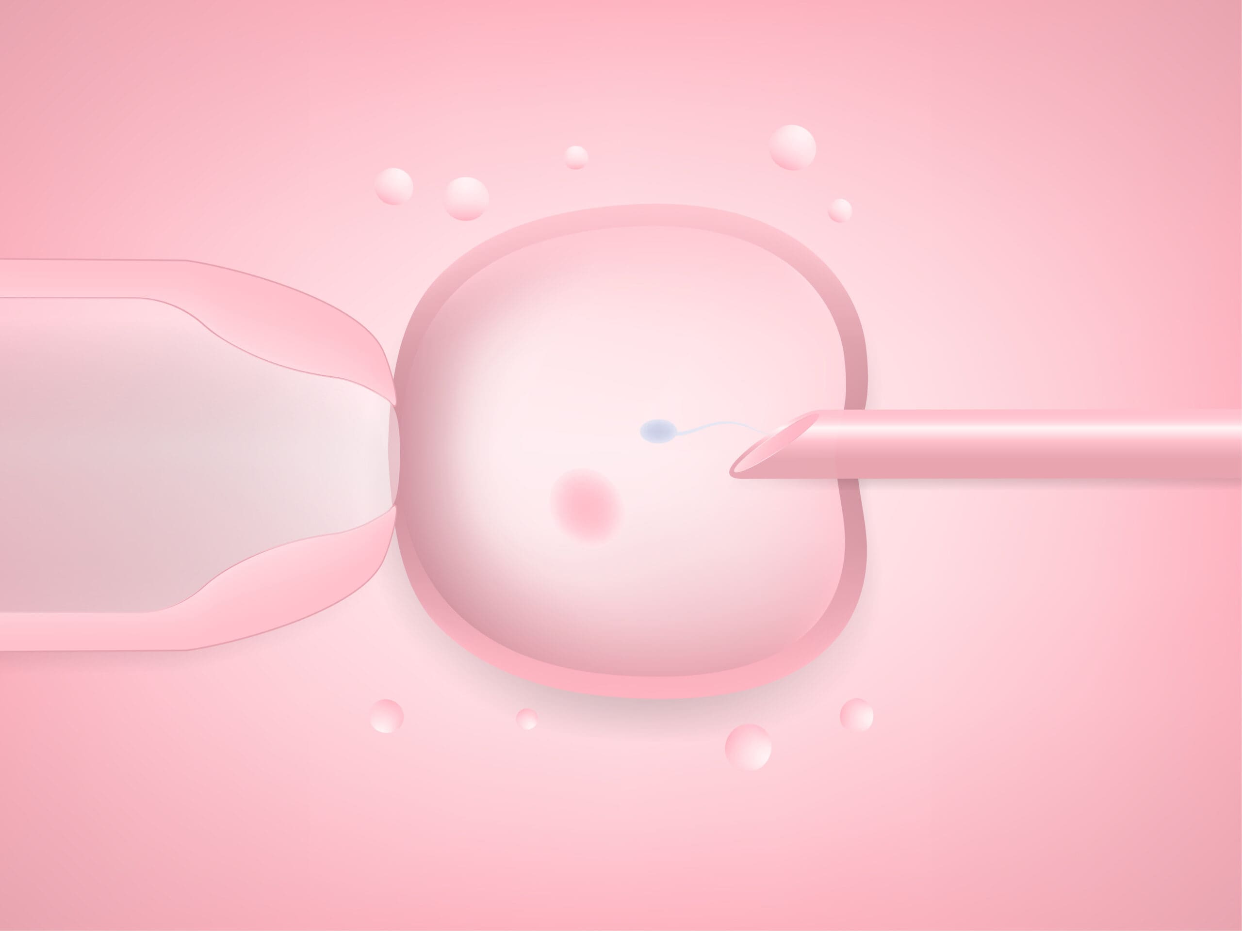 What Is Intracytoplasmic Sperm Injection (ICSI)? Dr. Katrina Rowan