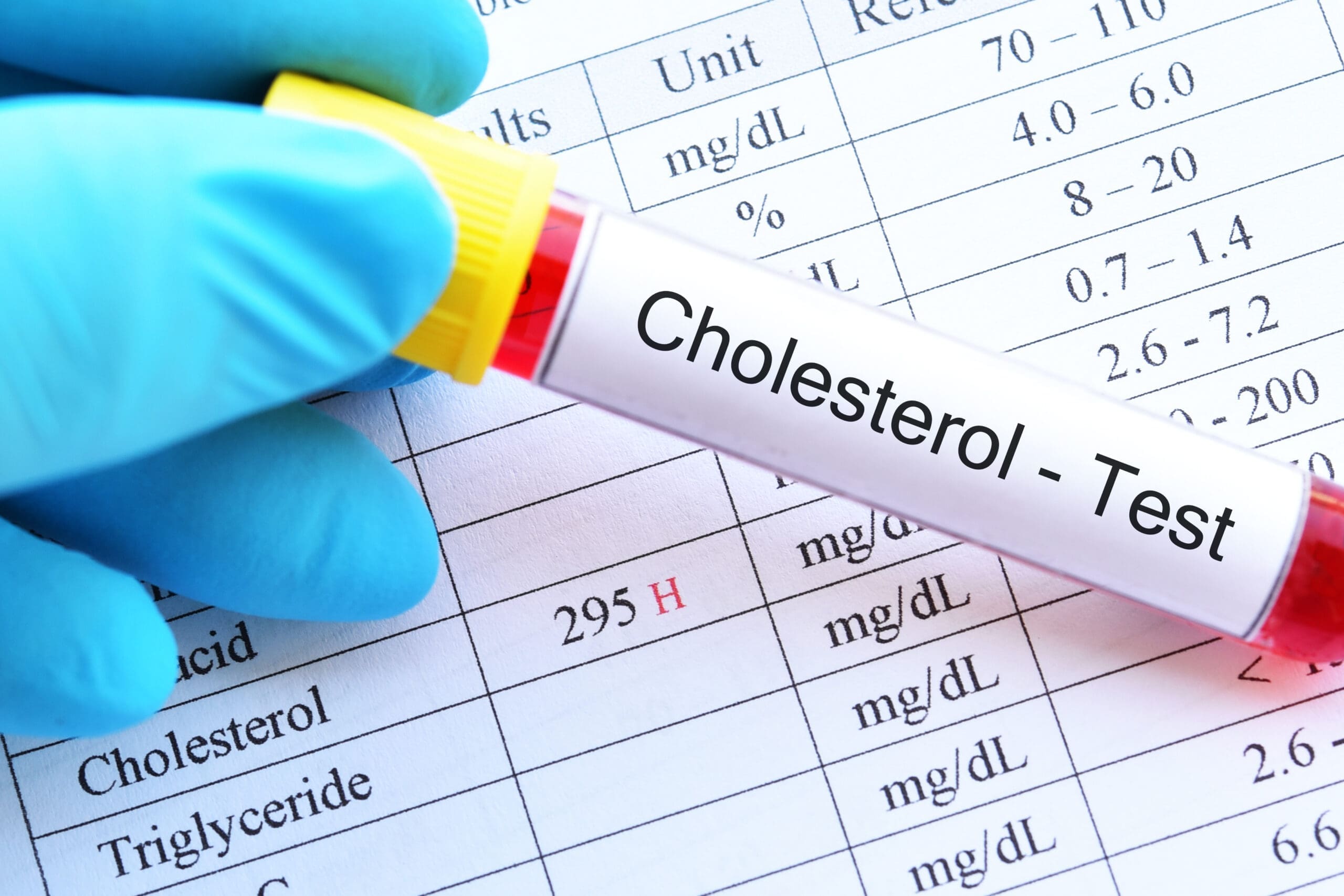 What Is Cholesterol? Dr. Norman Swan