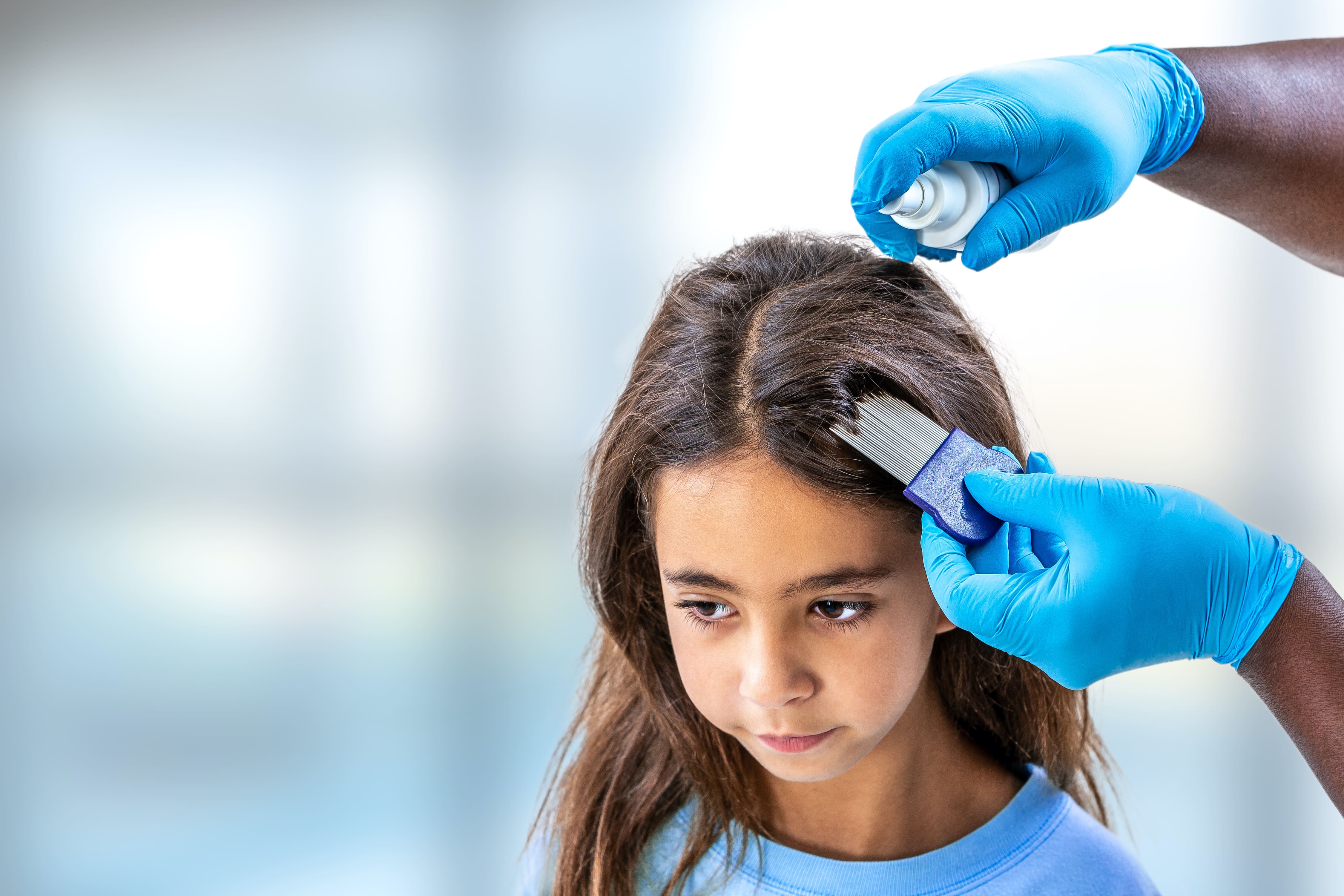 Video: How to treat head lice