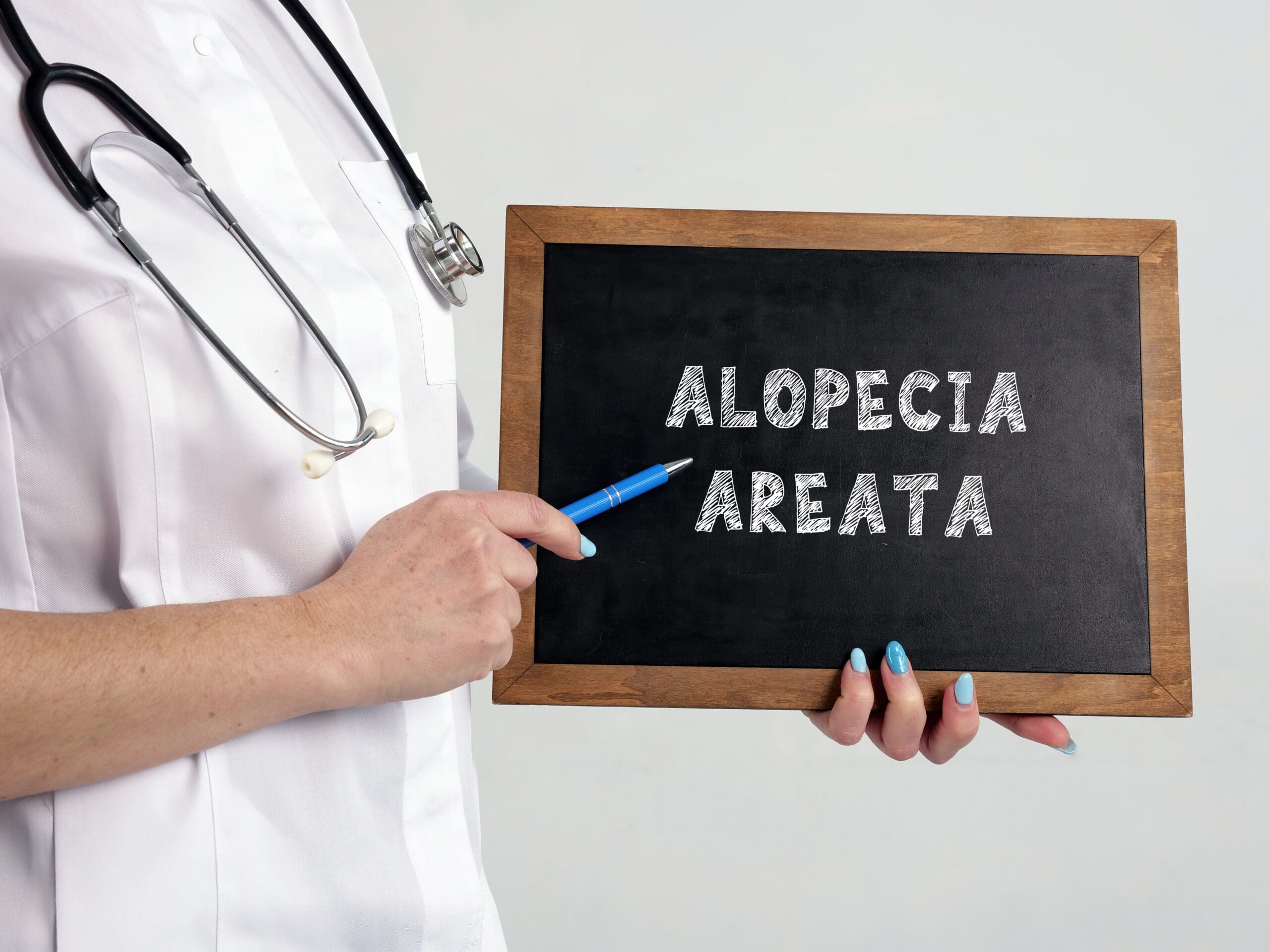 New Hope For 500,000 Australians Affected By Alopecia Areata