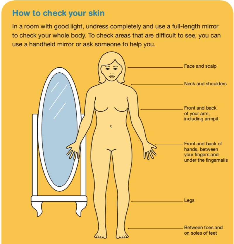 how to check for skin cancer