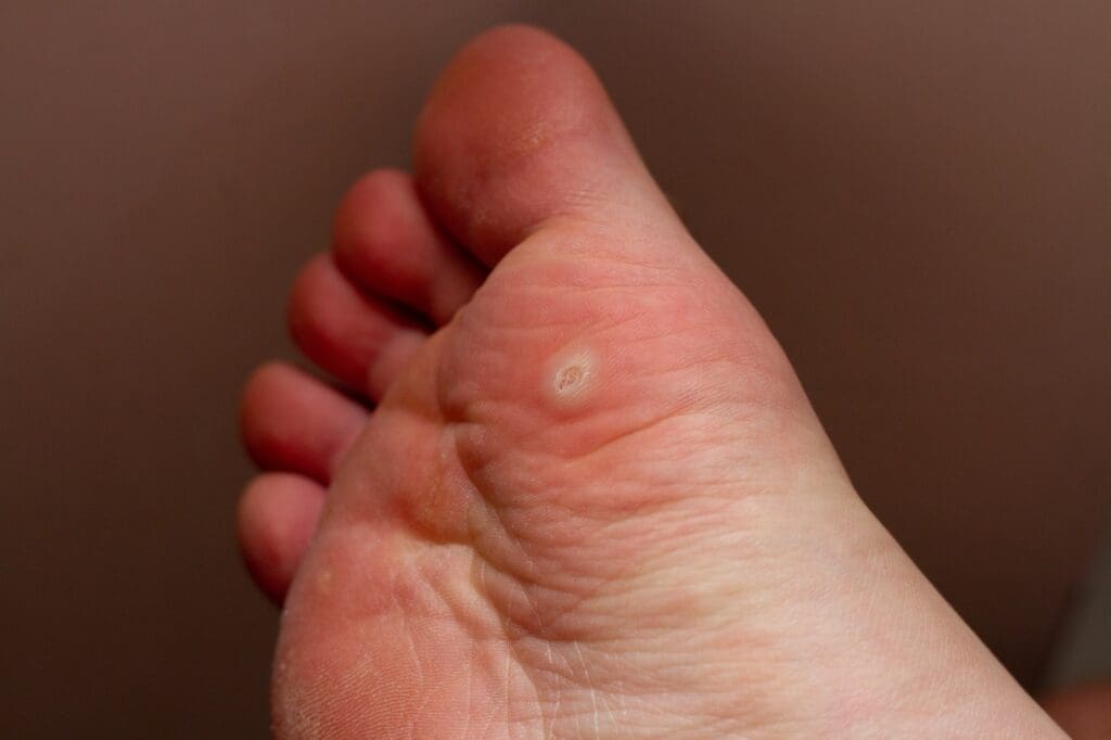 Foot Pain Top 10 Causes MyDr au Foot Pain Top 10 Causes MyDr au