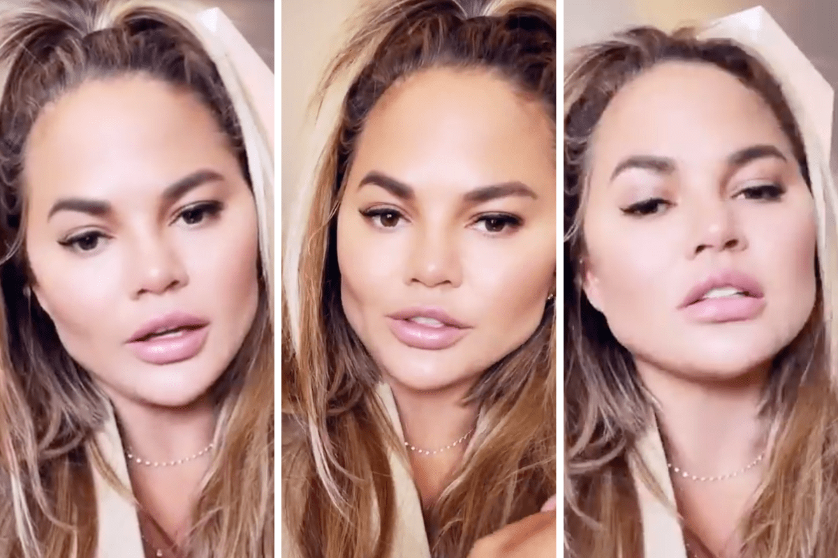 Chrissy Teigen discusses her Buccal Fat Removal procedure on social media