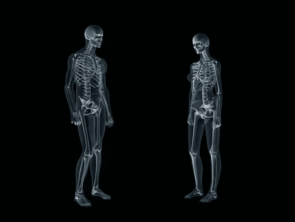 bone scan of male and female body who may have osteoporosis