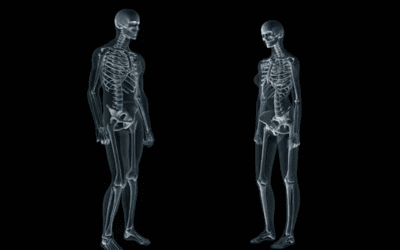 Why are women at greater risk of developing osteoporosis than men?